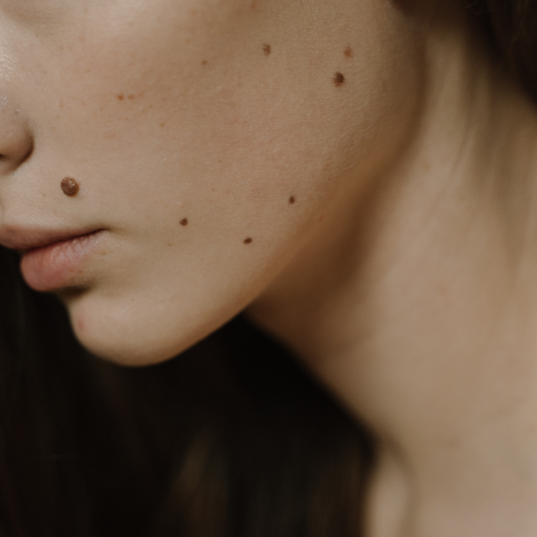 Grain de beauté au maquillage permanent